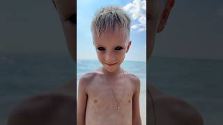 This Kid Has Super Black Eyes, How Did He Get Them?