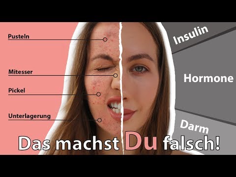 Bewertungen von Blutzuckermesser Blutanalyse zeigt, dass Insulin und C-Peptid