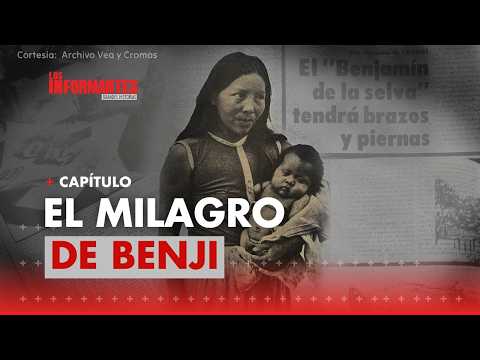 Casi 50 años después, aparece colombiano sin brazos ni piernas llevado a EE. UU. para tratamiento