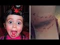 Parents Think Age 5 Daughter Had Bruise On Back Of Knee, Then Doctors Reveal Horrifying Truth