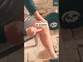 Try This Help Reduce Knee Pain And Rehab Your MCL Faster Pain Knee Mcl