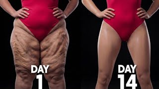 Download lagu Lose Inner Thigh, Thigh & Hip Fat at Home 🔥 | 10 Min Fat Burning Workout | No Jumping mp3 Download lagu Lose Inner Thigh, Thigh & Hip Fat at Home 🔥 | 10 Min Fat Burning Workout | No Jumping mp3