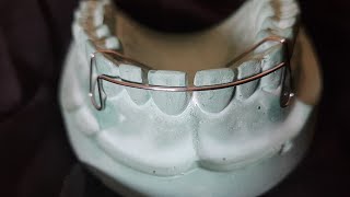 Download lagu Easy way to fabricate Labial Bow | Method 2 | Short Labial Bow | Orthodontics mp3