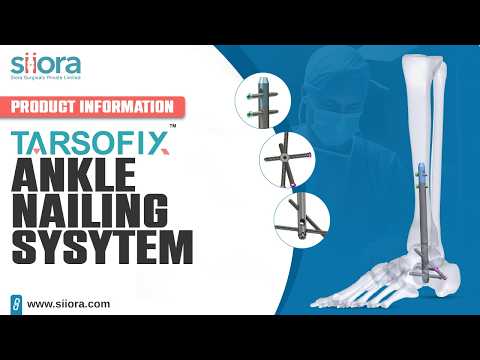 Product Information of TARSOFIX Ankle Nailing System