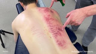 *SHOCKING* Marks Come From Their Skin 😳 *Cracks* Bring Relief For Men Too Young For Back Pain!!