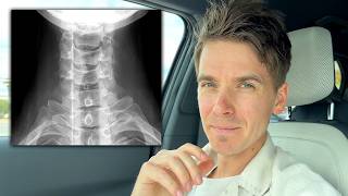 Turns out my neck needs fixing