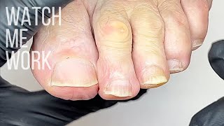 Wellness Pedicure: Gentle elderly foot care