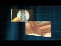 Body In Pain Premieres Thursday Jan 26 On WVIZ PBS Ideastream