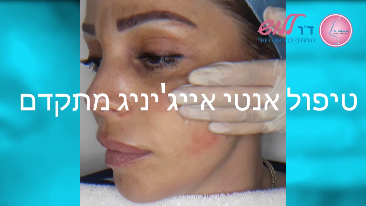 טיפול אנטי-אייג'יניג מתקדם למיצוק והעלמת קמטים בפנים, הצוואר והדקולטה