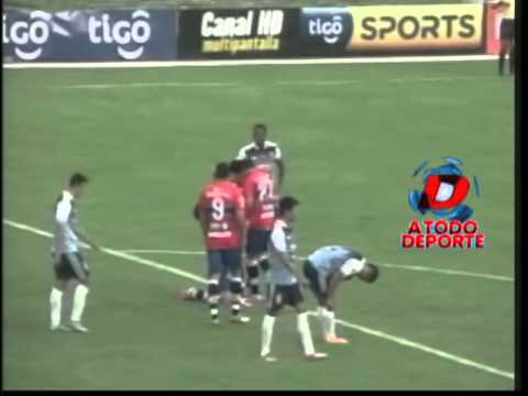 Apertura Fecha 22: Universitario 4 – 2 Blooming