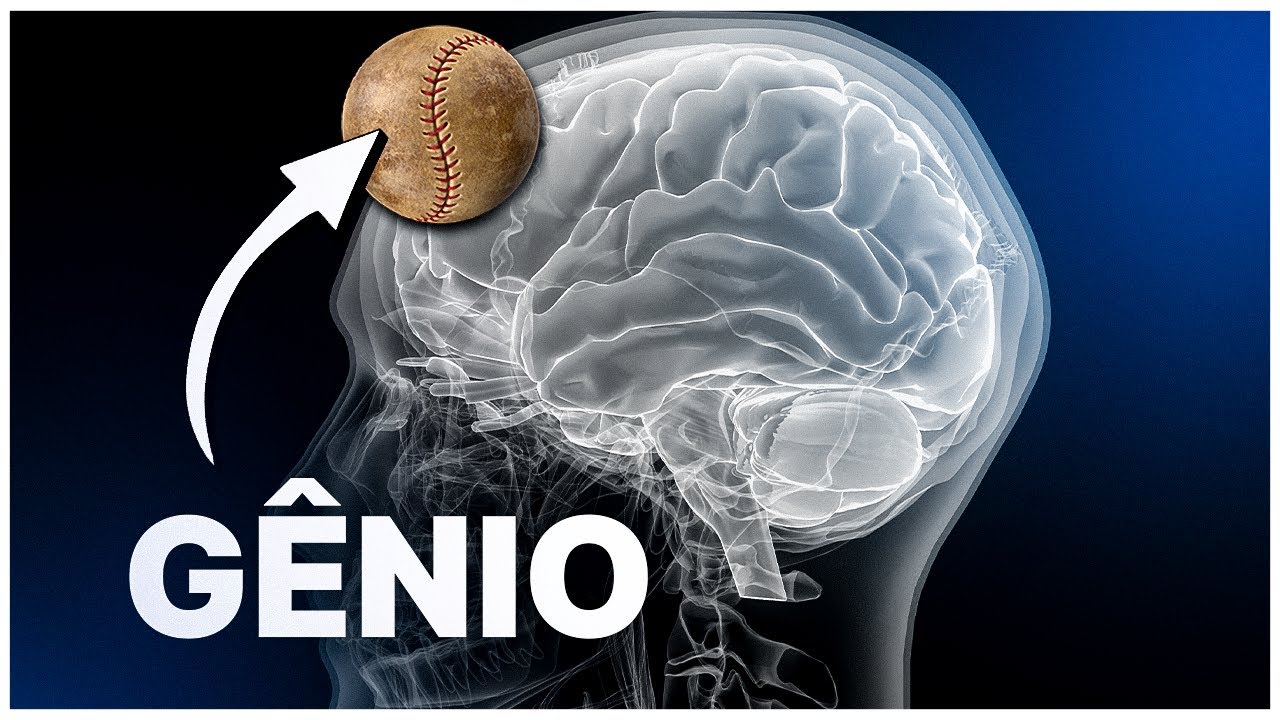 COMO uma LESÃO CEREBRAL criou um GÊNIO