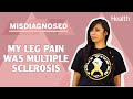 My Leg Pain Was Actually MS | Multiple Sclerosis #Misdiagnosed | Health