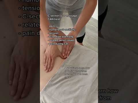 C-section scar massage benefits #csectionrecovery #newmum #newmom #postpartum