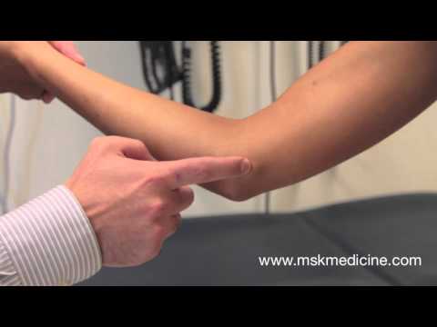 Tinel's Sign (Elbow)