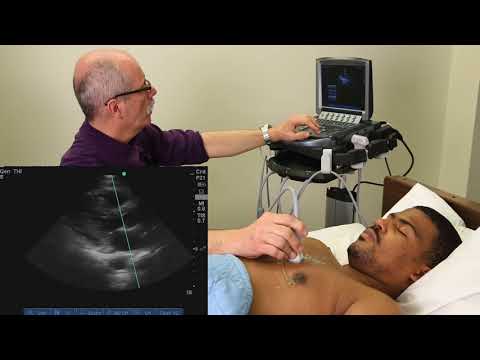 Advanced Critical Care Echocardiography - Complete Exam