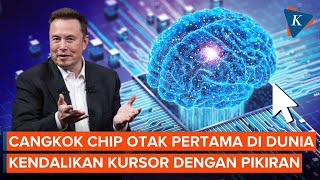 Download lagu Manusia Cangkok Chip di Otak Pertama di Dunia, Bisa Gerakkan “Mouse” dengan Pikiran mp3 Download lagu Manusia Cangkok Chip di Otak Pertama di Dunia, Bisa Gerakkan “Mouse” dengan Pikiran mp3