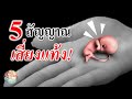 อาการ
