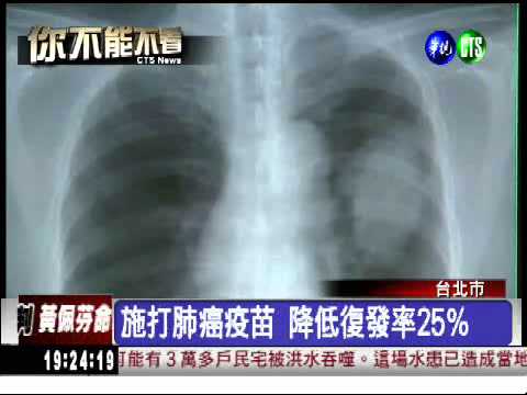 肺癌疫苗 降低復發率25％