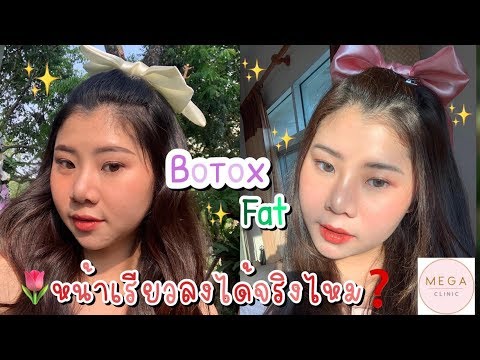 เมโสแฟต ยี่ห้อไหนดี
