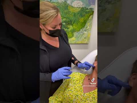 What Is RHA Filler for Earlobes and Who Needs It?