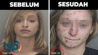 Download lagu Ngeri!! Ada yang Berakhir Jadi Gelandangan, Beginilah Transformasi Memilukan Wajah Pecandu Narkoba mp3