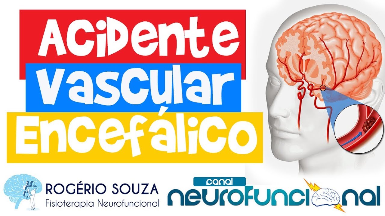 ACIDENTE VASCULAR ENCEFÁLICO (Aula Completa) - Rogério Souza