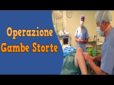 Artrite degli antibiotici ginocchio Articolazioni fanno male recensioni