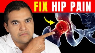No BS Advice to Fix Hip Arthritis in 90 Days