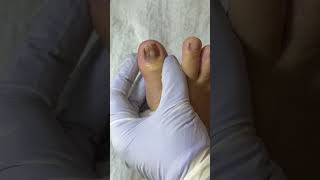 Ep_8286 Foot nails skin removal 👣 เอาหนังออกแล้ว..หายคันเลยค่ะ 😄 (clip from Thailand)