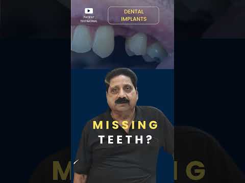 Painless Full Mouth Dental Implant Experience