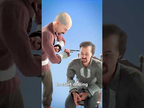 Drilling A Hole In Your Head?? 😨