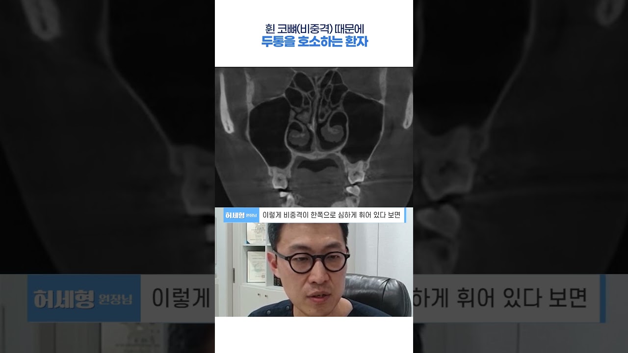 휜 코뼈(비중격) 때문에 두통을 호소하는 환자