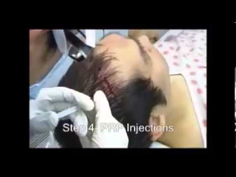 Carica in osteocondrosi della lombosacrale Moto mal di schiena