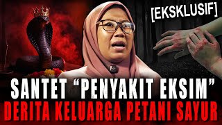 Download lagu RUQYAH VS SANTET !! GATAL2 EKSIM PARAHHH UDAH KAYAK ULAR GANTI KULIT (PETANI SAYUR & SILUMAN ULAR) mp3