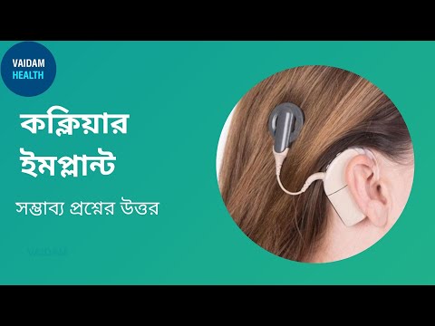 ককলিয়ার ইমপ্লান্ট- প্রায়শই জিজ্ঞাসিত প্রশ্ন