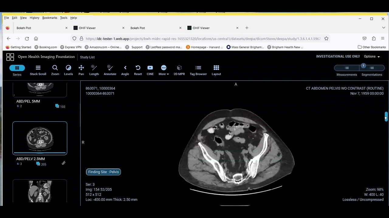 Integrating deep learning algorithms with Medical Imaging and Data Resource Center (MIDRC)