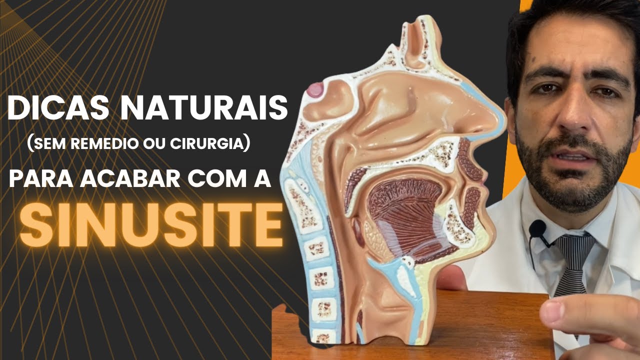 Dicas naturais para acabar com a sinusite