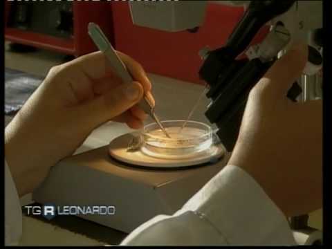Tipi di helminths e le loro uova Analisi ptsr chilocaloria lyambliya