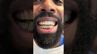 Drip Drop 🫟🤩 #grillzbyscotty