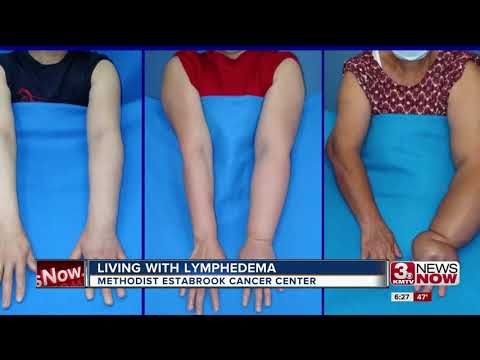 Living with Lymphedema