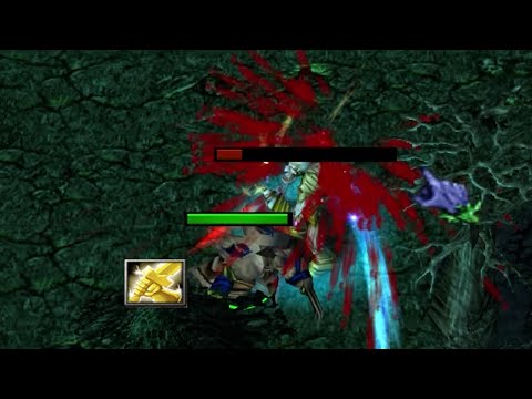 DOTA BLOODSEEKER FAST 12 MINUTE RADIANCE = 30 KILLS