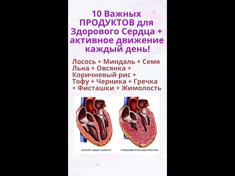 10 важных продуктов для здорового сердца + движение каждый день.
