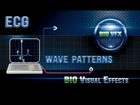 (ECG or EKG) Wave patterns. Part 2