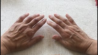 【強皮症 リウマチ】８月まとめ：心エコー、胸部CT、歯科受診／繕い物