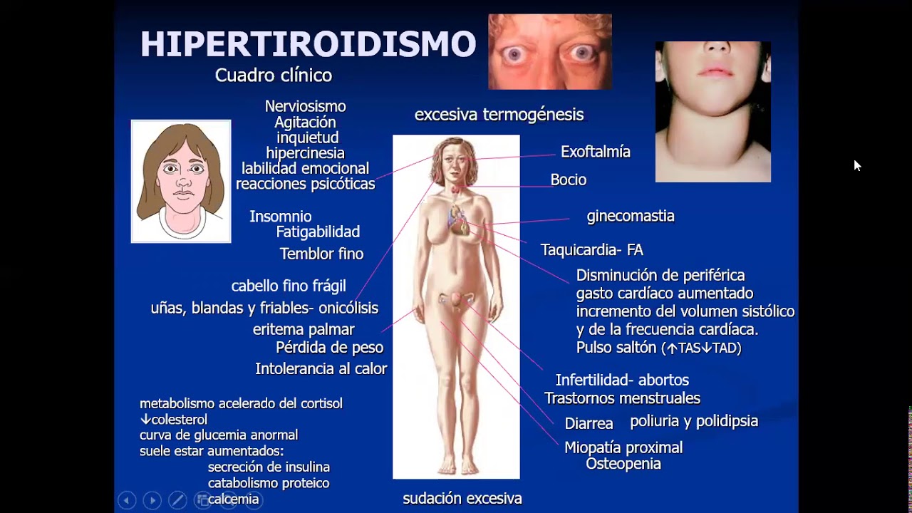 Farmacos Tiroideos 2da parte