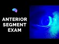 Anterior Segment Examination of the Eye - OSCE Guide | UKMLA | CPSA