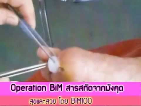 ยาเสพติดสำหรับหัวโรคสะเก็ดเงิน โรคสะเก็ดเงินผ่านตัวเอง