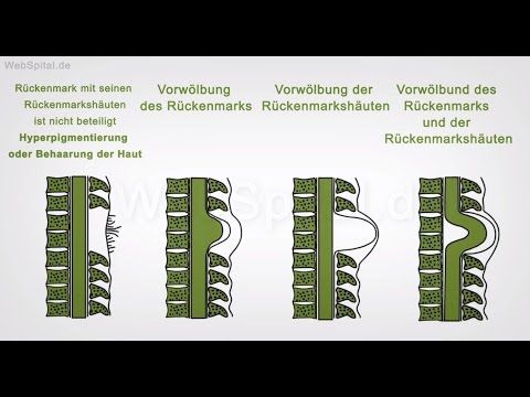 Quanten Behandlung von Prostatitis Zuhause Physiotherapiegeräte Prostatitis