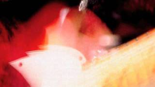 Dream Syndicate  - Still Holding On To You - Live