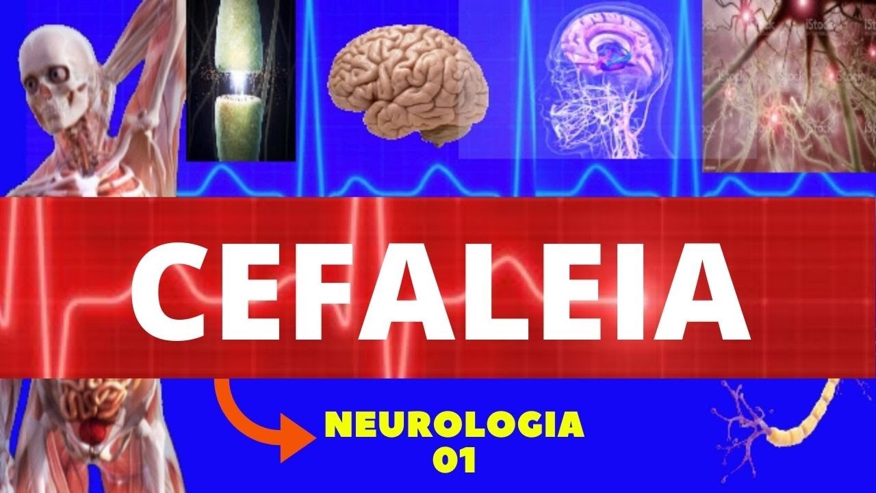 CEFALEIA (DOR DE CABEÇA) - ENTENDA TUDO SOBRE CEFALEIA - NEUROLOGIA